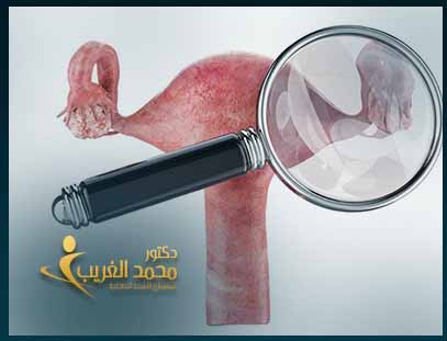 اورام الكبد